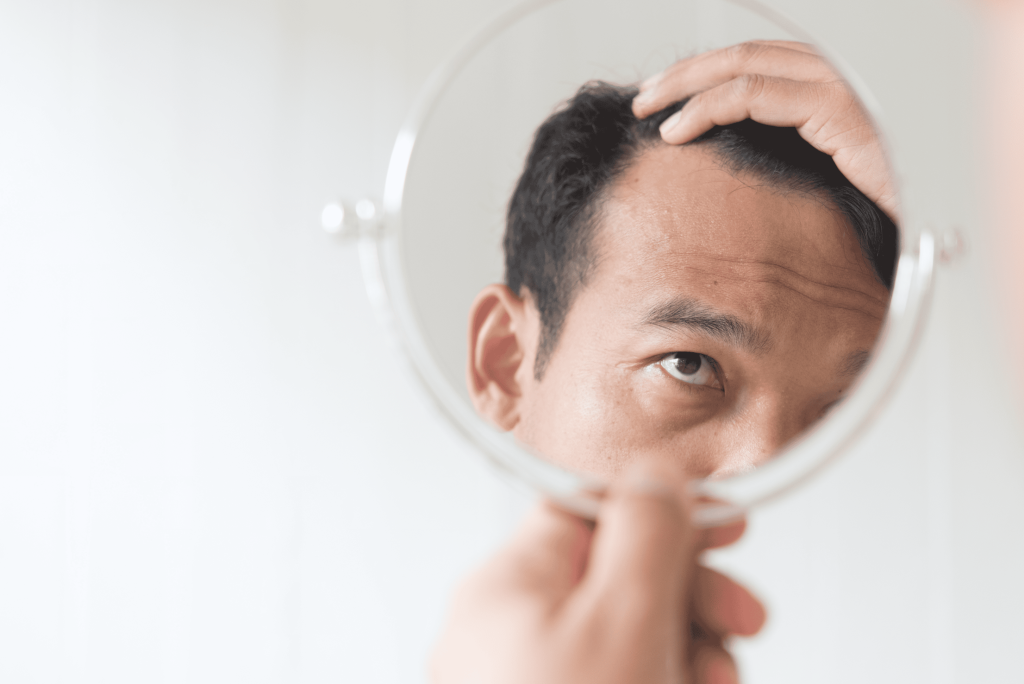 hairfall