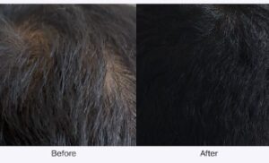 Science Behind Hair Growth